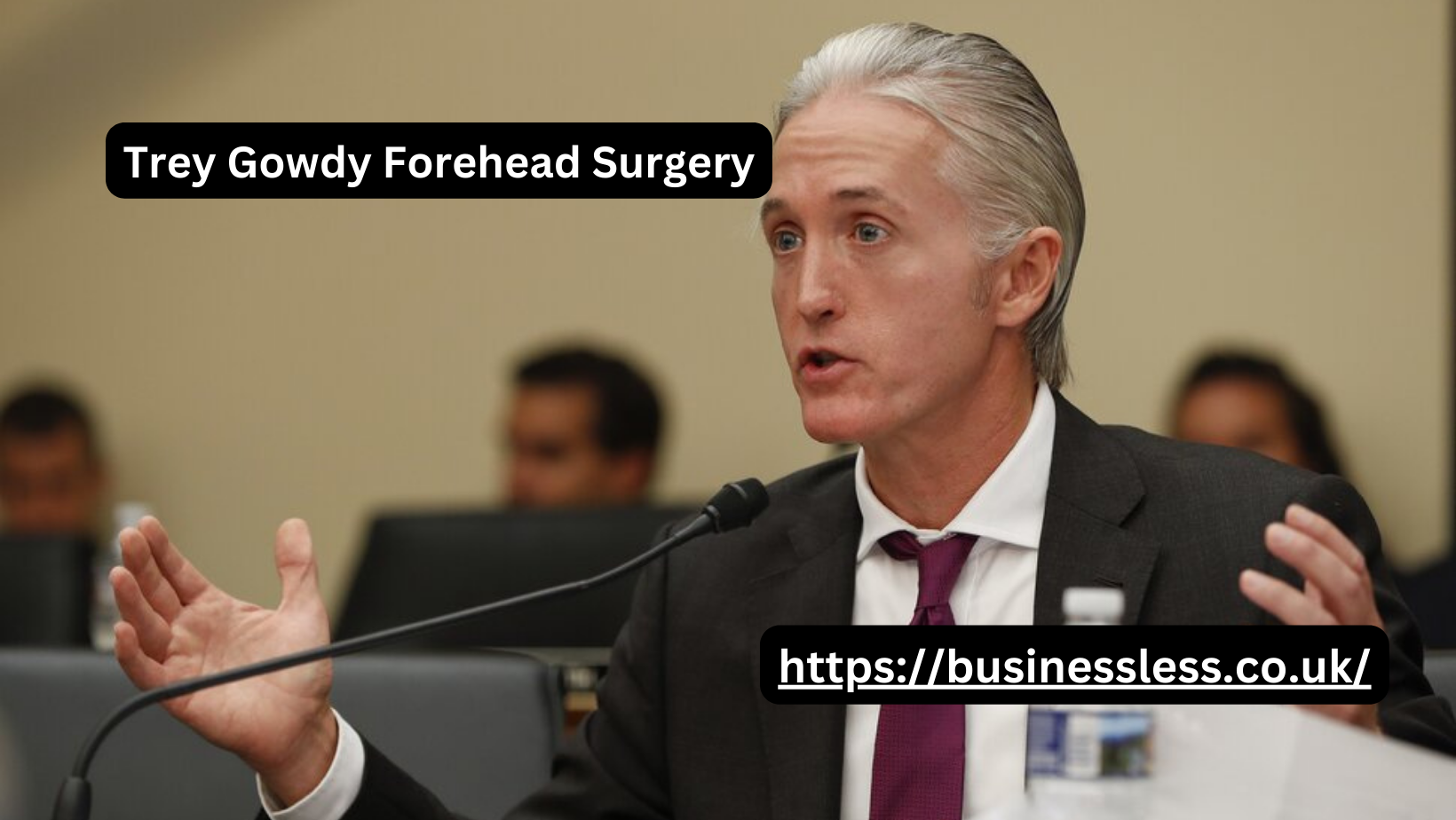 Trey Gowdy Forehead Surgery: What’s the Story Behind It?